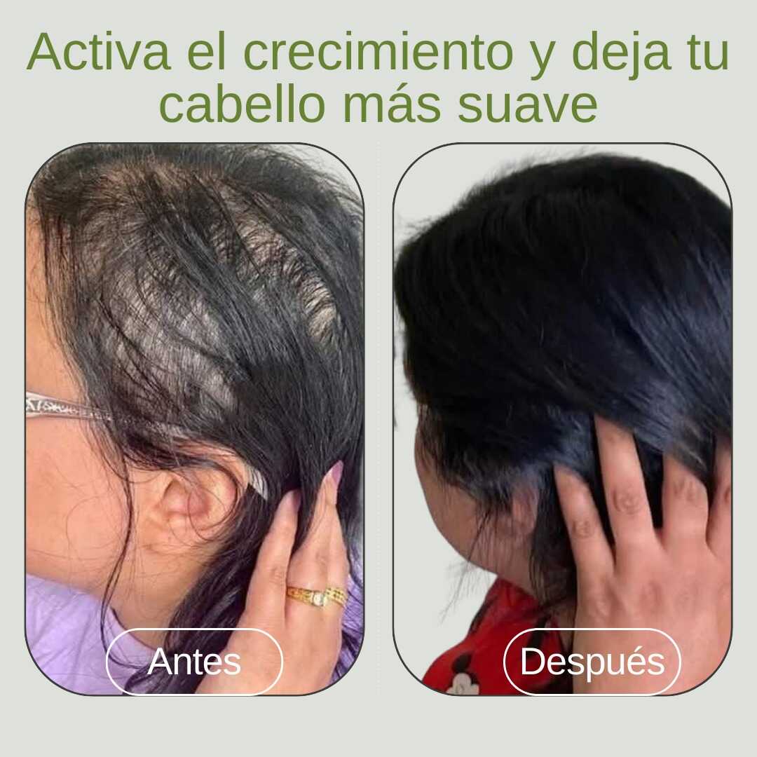 Kit FortaCrec Capilar Acelerado - Romero, Cebolla y Gotas de Seda (-10% OFF + Envío Gratis + Regalo Sorpresa).