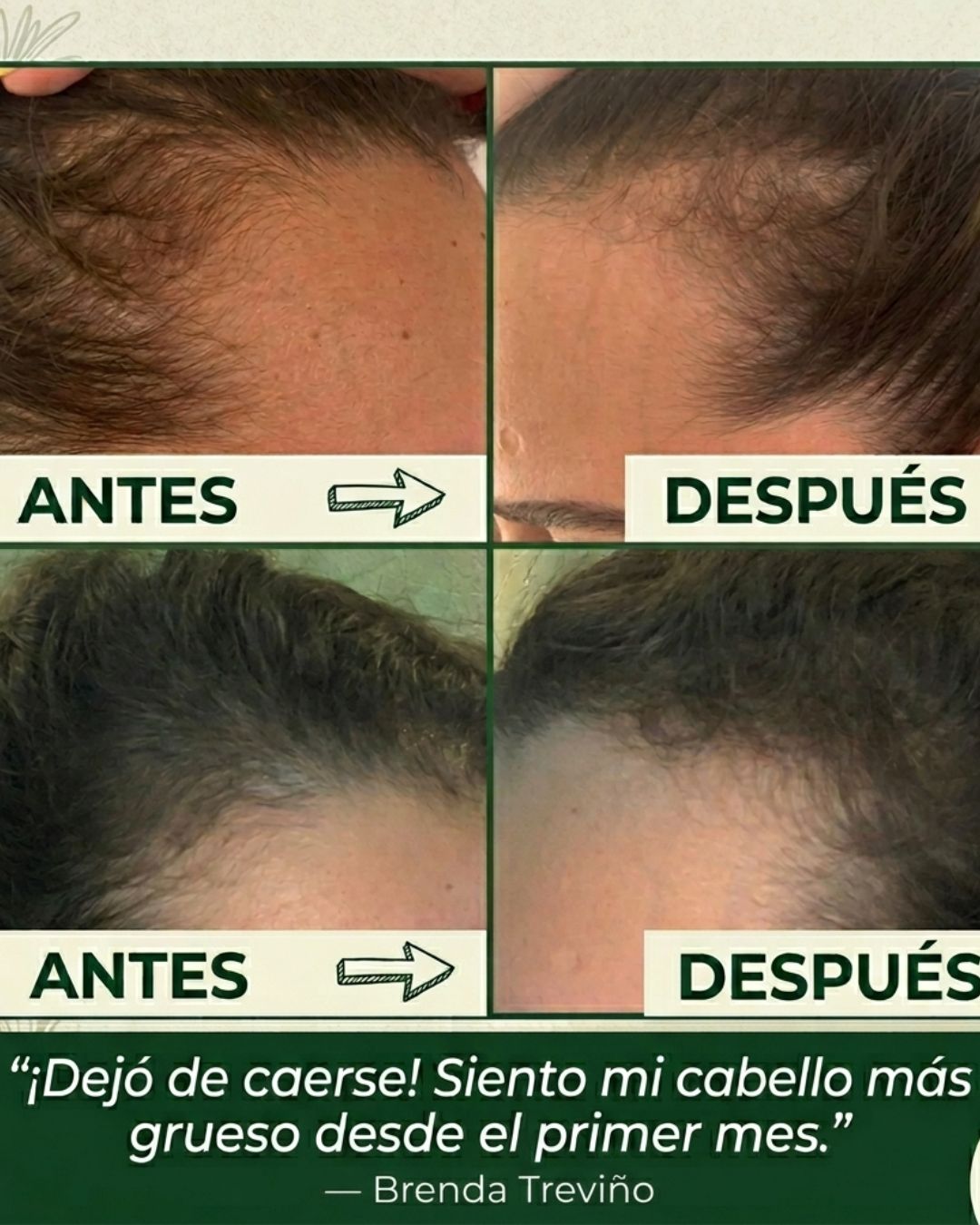 Paquete Romero Rapunzel | Cabello Más Fuerte y Saludable