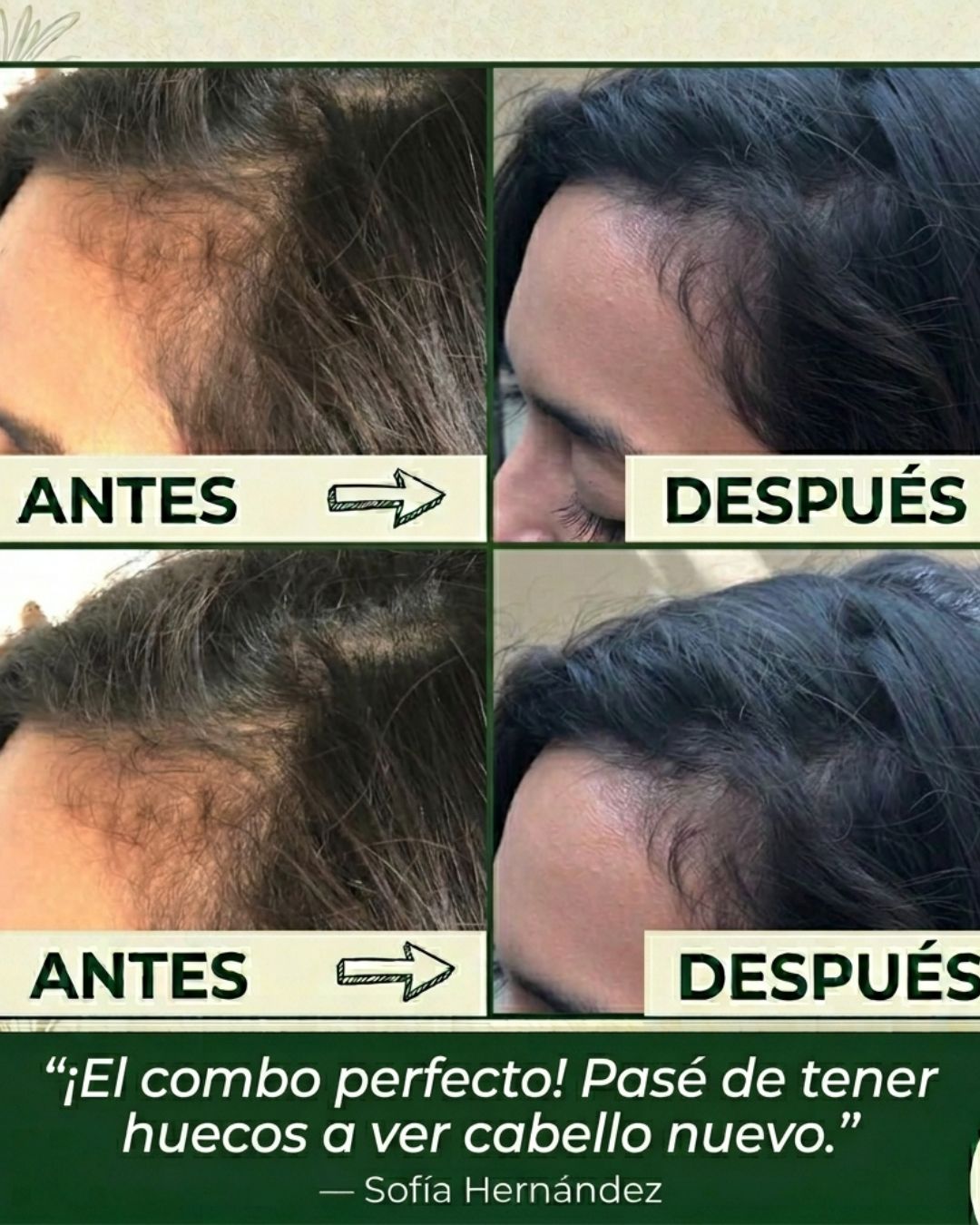 Paquete Romero Rapunzel | Cabello Más Fuerte y Saludable