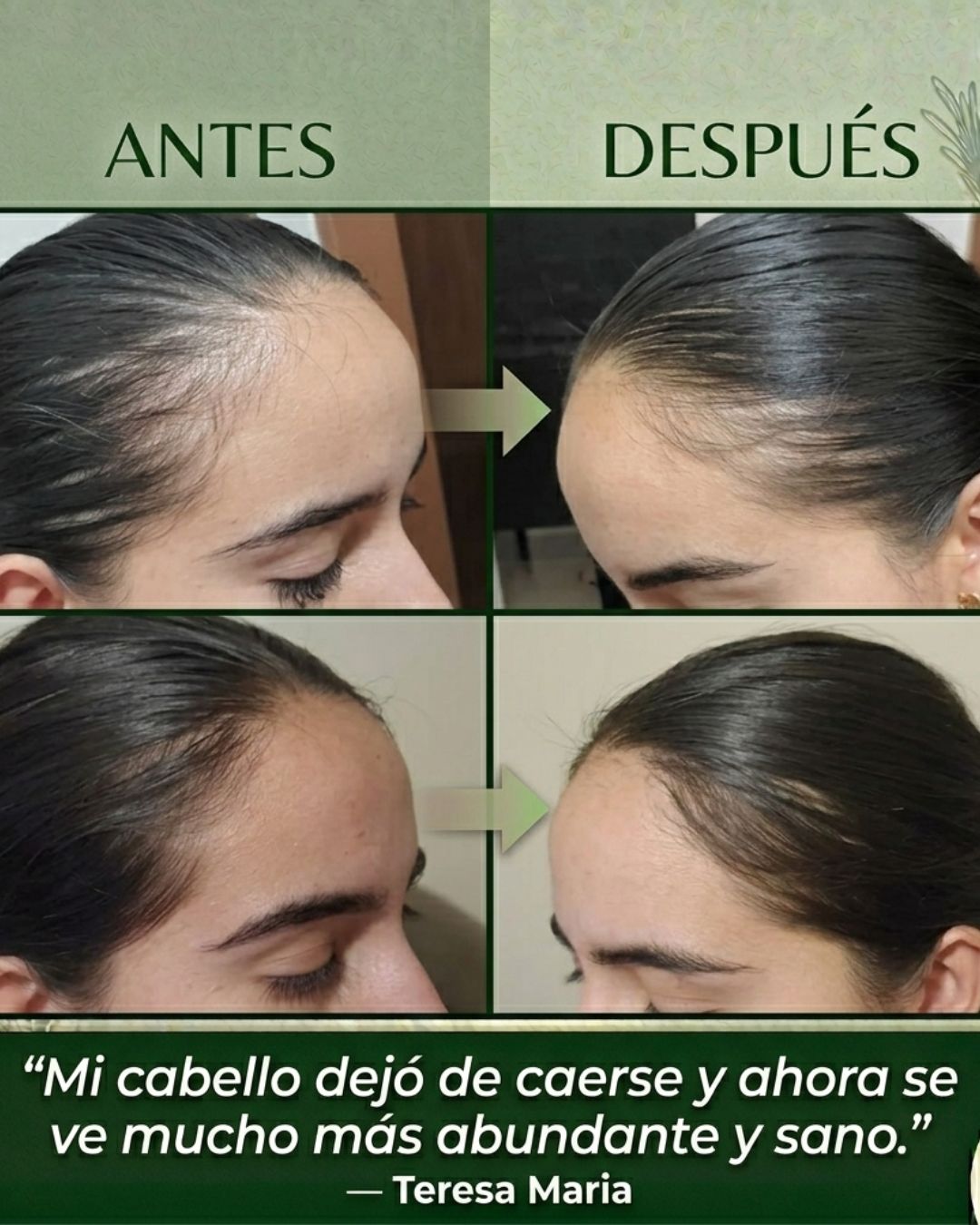Paquete Romero Rapunzel | Cabello Más Fuerte y Saludable